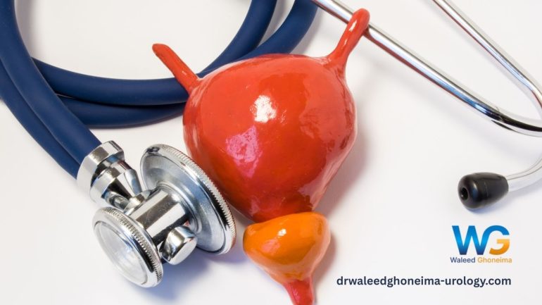 تضخم البروستاتا الحميد